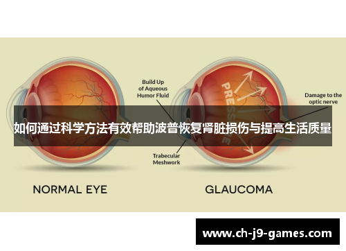 如何通过科学方法有效帮助波普恢复肾脏损伤与提高生活质量 如何通过科学方法有效帮助波普恢复肾脏损伤与提高生活质量